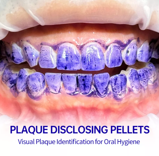 Plaque Disclosing Tablets