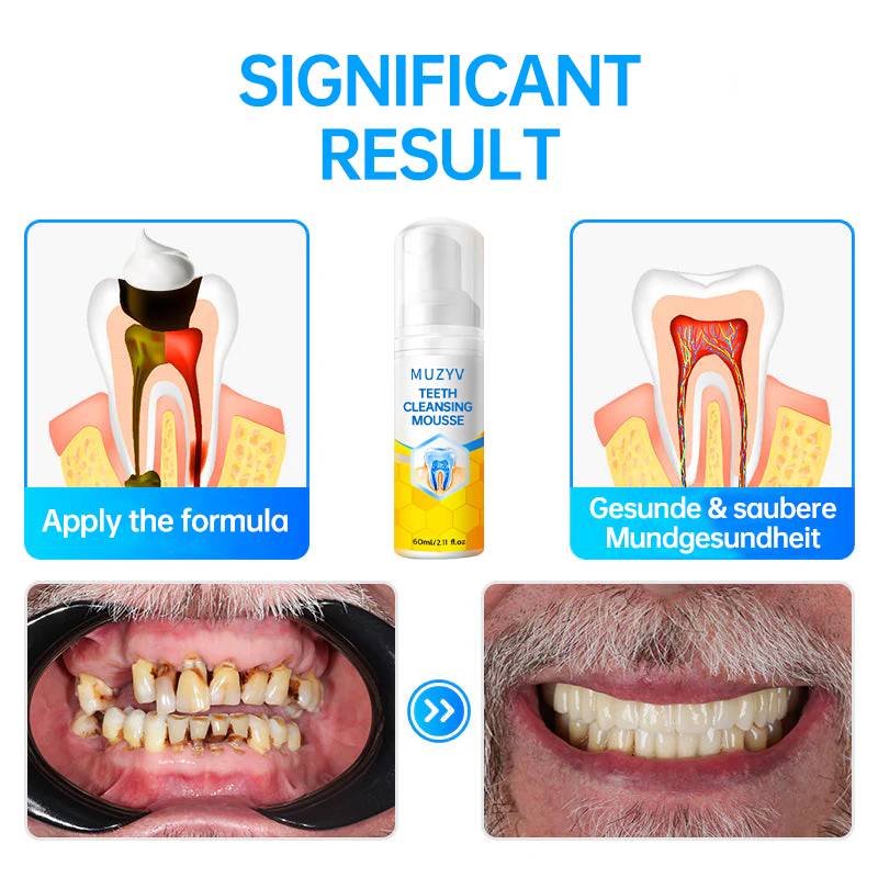 Propolis Teeth Cleansing Mousse – Gentle Oral Foam with Herbal Extracts