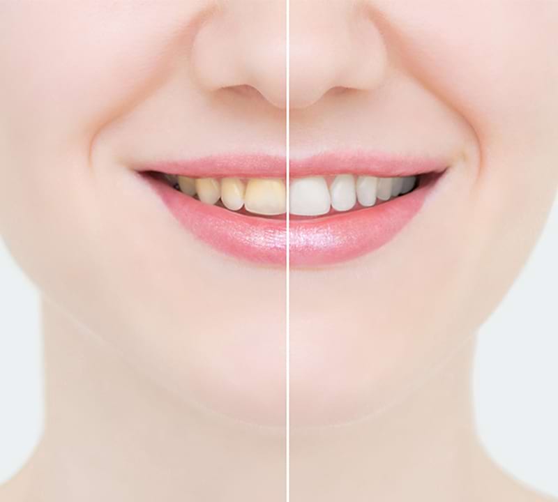 mouthwash tablets manufacturer