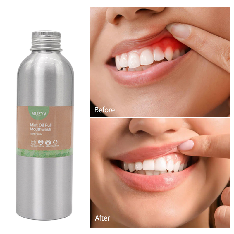 Customized Mint Oil Pulling Mouthwash