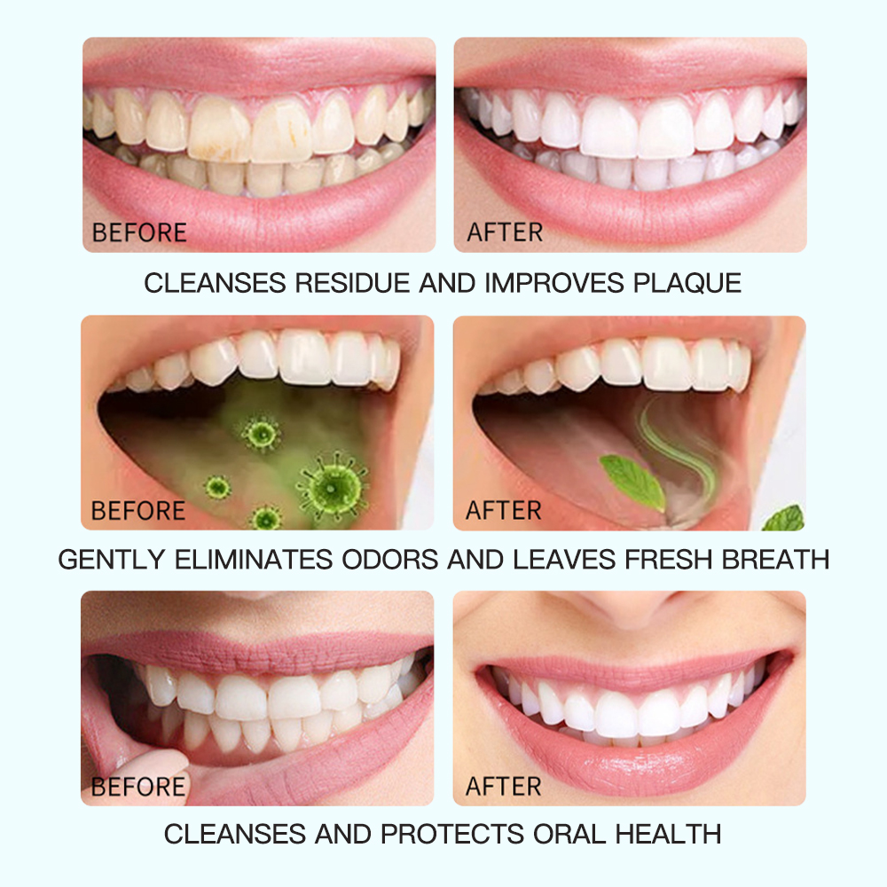 Dual Phase Coconut Oil Xylitol Pop-Bead Oral Essence