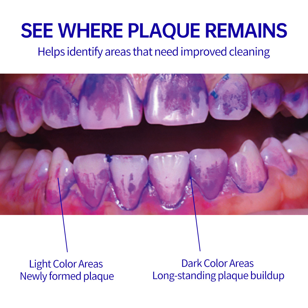 Plaque Disclosing Pellets – Visual Plaque Indicator for Oral Hygiene