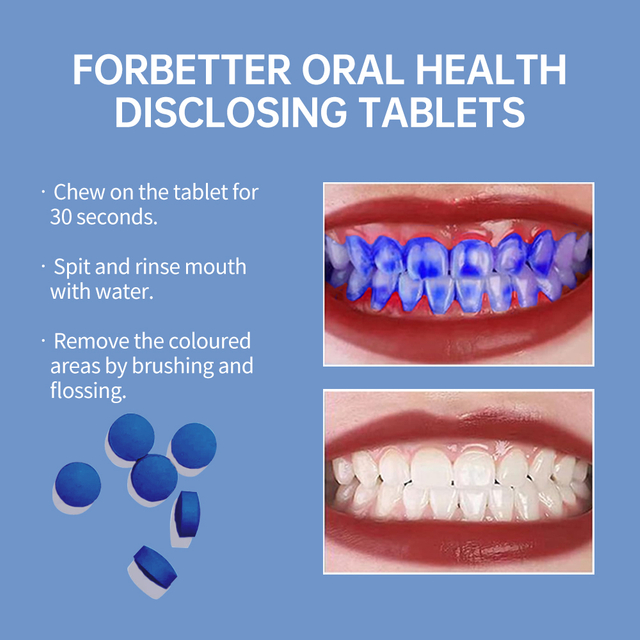 Dental Plaque Disclosing Tablets for Effective Brushing Checks