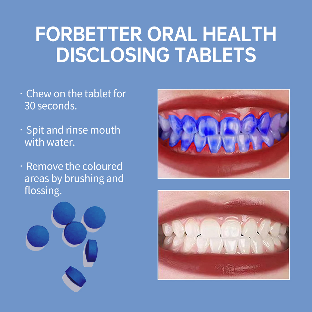 Dental Plaque Disclosing Tablets for Effective Brushing Checks